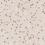 MTA1 Antibody in Immunohistochemistry (Paraffin) (IHC (P))