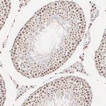 MTA1 Antibody in Immunohistochemistry (Paraffin) (IHC (P))