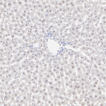 MTA1 Antibody in Immunohistochemistry (Paraffin) (IHC (P))