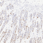 MTA1 Antibody in Immunohistochemistry (Paraffin) (IHC (P))