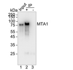MTA1 Antibody in Immunoprecipitation (IP)
