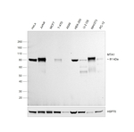 MTA1 Antibody