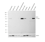 MTA1 Antibody