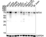 MTA1 Antibody in Western Blot (WB)