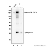 Phospho-LATS1 (Thr1079) Antibody in Immunoprecipitation (IP)