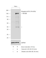 Phospho-LATS1 (Thr1079) Antibody