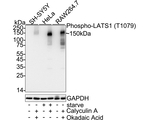 Phospho-LATS1 (Thr1079) Antibody in Western Blot (WB)