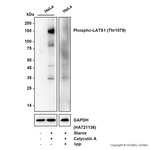 Phospho-LATS1 (Thr1079) Antibody in Western Blot (WB)