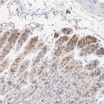 NFATC3 Antibody in Immunohistochemistry (Paraffin) (IHC (P))