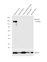 NFATC3 Antibody