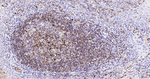 Human IgM Monoclonal Antibody (2B8)