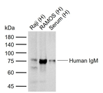 Human IgM Antibody in Western Blot (WB)