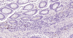 Human IgA Monoclonal Antibody (7H8)