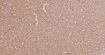alpha Synuclein Recombinant Rabbit Monoclonal Antibody (7B7)