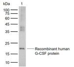 G-CSF Monoclonal Antibody (2C7)