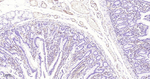 CD31 Antibody in Immunohistochemistry (Paraffin) (IHC (P))