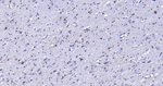 S100B Antibody in Immunohistochemistry (Paraffin) (IHC (P))