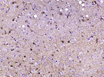 S100B Antibody in Immunohistochemistry (Paraffin) (IHC (P))