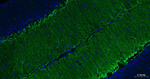 S100B Antibody in Immunohistochemistry (Paraffin) (IHC (P))