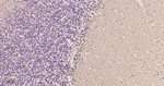 S100B Antibody in Immunohistochemistry (Paraffin) (IHC (P))