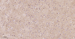 S100B Antibody in Immunohistochemistry (Paraffin) (IHC (P))