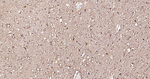S100B Antibody in Immunohistochemistry (Paraffin) (IHC (P))