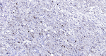 S100B Antibody in Immunohistochemistry (Paraffin) (IHC (P))