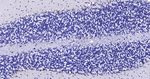 S100B Antibody in Immunohistochemistry (Paraffin) (IHC (P))