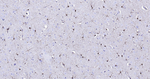 S100B Antibody in Immunohistochemistry (Paraffin) (IHC (P))