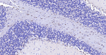 S100B Antibody in Immunohistochemistry (Paraffin) (IHC (P))