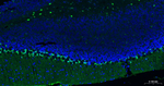 S100B Antibody in Immunohistochemistry (Paraffin) (IHC (P))