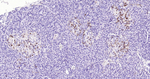 S100B Antibody in Immunohistochemistry (Paraffin) (IHC (P))