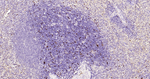 S100B Antibody in Immunohistochemistry (Paraffin) (IHC (P))