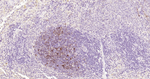 S100B Antibody in Immunohistochemistry (Paraffin) (IHC (P))