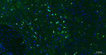 S100B Antibody in Immunohistochemistry (Paraffin) (IHC (P))