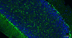 S100B Antibody in Immunohistochemistry (Paraffin) (IHC (P))