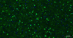 S100B Antibody in Immunohistochemistry (Paraffin) (IHC (P))