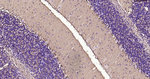 S100B Antibody in Immunohistochemistry (Paraffin) (IHC (P))