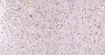 S100B Antibody in Immunohistochemistry (Paraffin) (IHC (P))