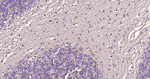 S100B Antibody in Immunohistochemistry (Paraffin) (IHC (P))