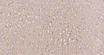 S100B Antibody in Immunohistochemistry (Paraffin) (IHC (P))