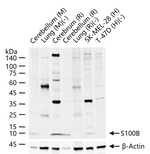 S100B Antibody in Western Blot (WB)