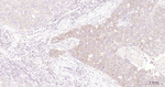 Bcl-2 Antibody in Immunohistochemistry (Paraffin) (IHC (P))