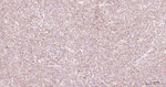 Bcl-2 Antibody in Immunohistochemistry (Paraffin) (IHC (P))
