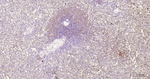 Bcl-2 Antibody in Immunohistochemistry (Paraffin) (IHC (P))