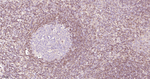 Bcl-2 Antibody in Immunohistochemistry (Paraffin) (IHC (P))