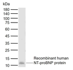 pro-Brain Natriuretic Peptide Monoclonal Antibody (11E6-1H4)