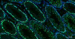 PCNA Antibody in Immunohistochemistry (Paraffin) (IHC (P))