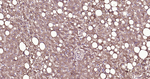 Oxidized LDL Antibody in Immunohistochemistry (Paraffin) (IHC (P))