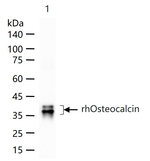 Osteocalcin Monoclonal Antibody (8H8)